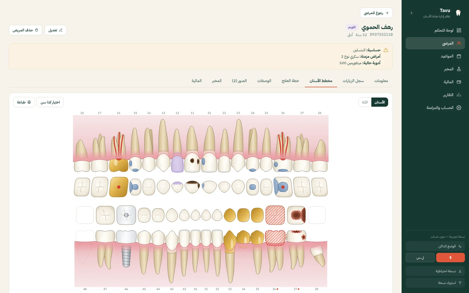 مخطط تشريحي يتبع عمر المريض، مع تنبيه الحساسية والأمراض المزمنة فوق ملفه.